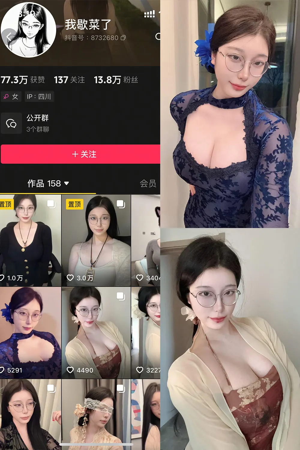 抖音 我歇菜了 微密圈 NO.001期 【10P】最新至：2025.4.19