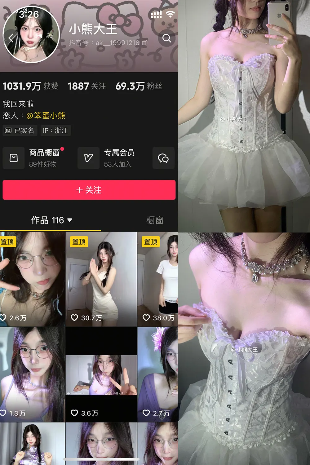 抖音 小熊大王 微密圈 001期 【32P】