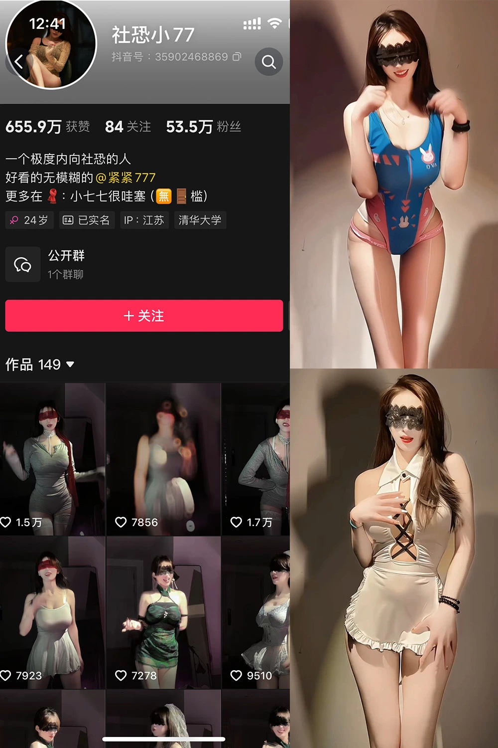 抖音 社恐小77 微密圈 002期 【20V】最新至：2025.3.11