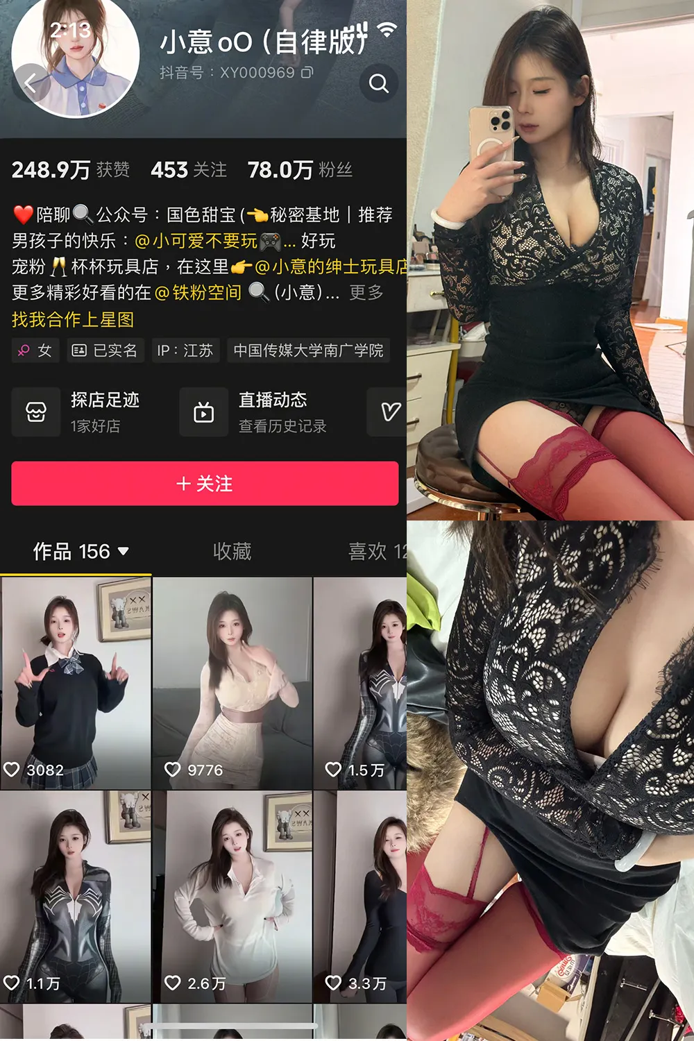 抖音 小意 微密圈  NO.003期 【15P1V】最新至：2025.3.11